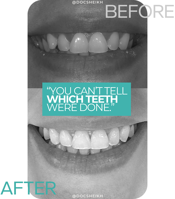 before and after (3)