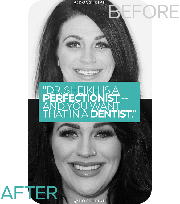 before and after (4)