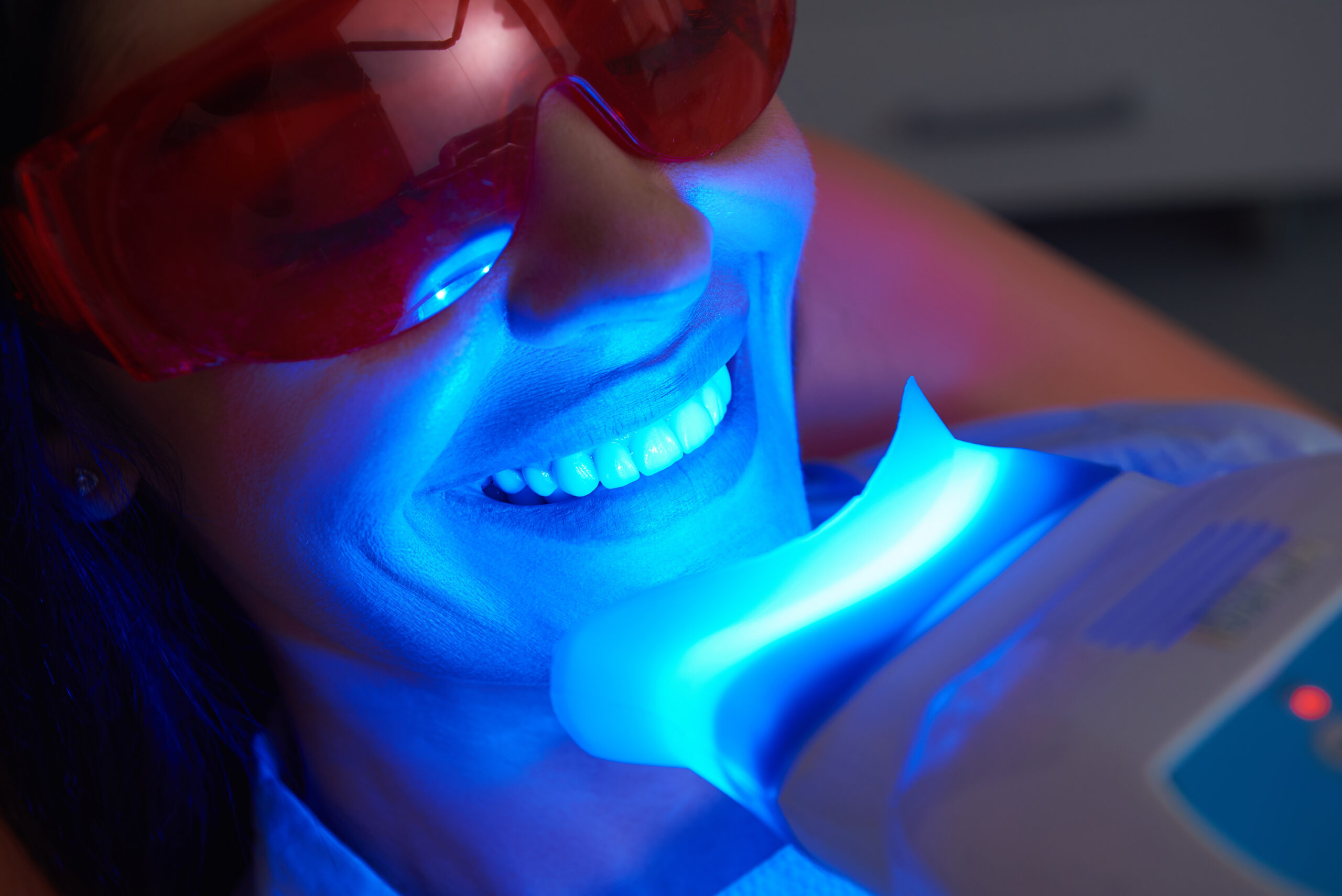 Unlock Your Radiant Smile: Teeth Whitening Options